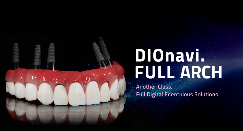 DIO IMPLANT  Digital Implant Solution